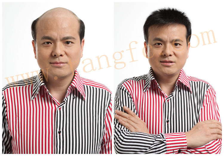 用什么洗頭可以生發(fā)？