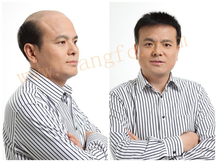 了解假發(fā)價(jià)格。高檔假發(fā)價(jià)格多少？