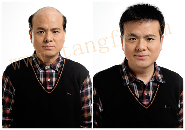 選擇男士假發(fā)需要注意什么？