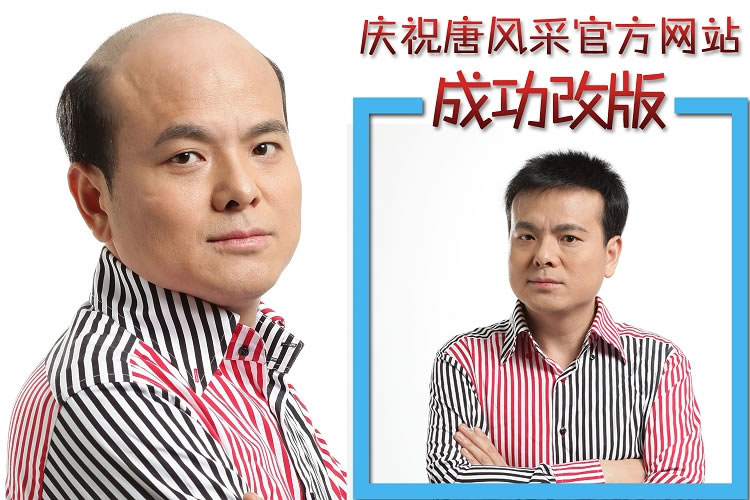 女生不脫發(fā)可以做增發(fā)么？