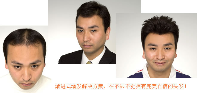 怎么洗頭才不容易脫發(fā)？