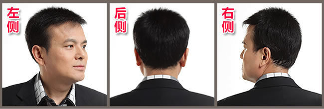 前額兩邊頭發(fā)稀疏怎么辦？看了你就知道怎么解決！