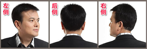 男人頭發(fā)稀少應該怎么解決？