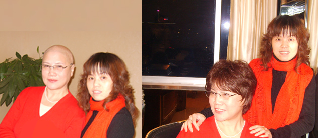 女士脂溢性脫發(fā)也可以用無痕織發(fā)補發(fā)嗎？