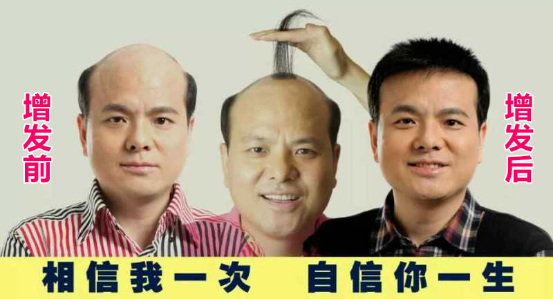 織發(fā)的費(fèi)用是多少？織發(fā)哪個(gè)牌子好？