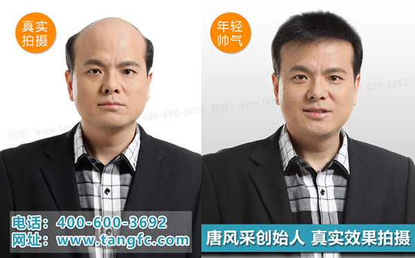 泉州假發(fā)什么牌子好？春節(jié)前尊享優(yōu)惠大禮