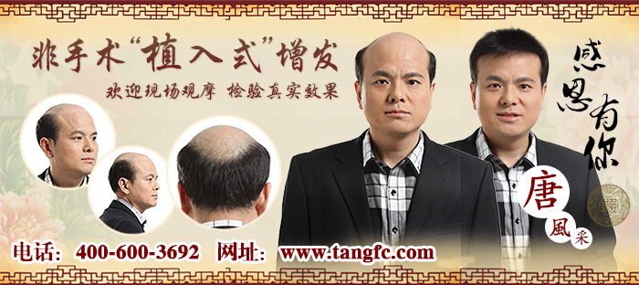 2015織發(fā)哪個(gè)牌子好？