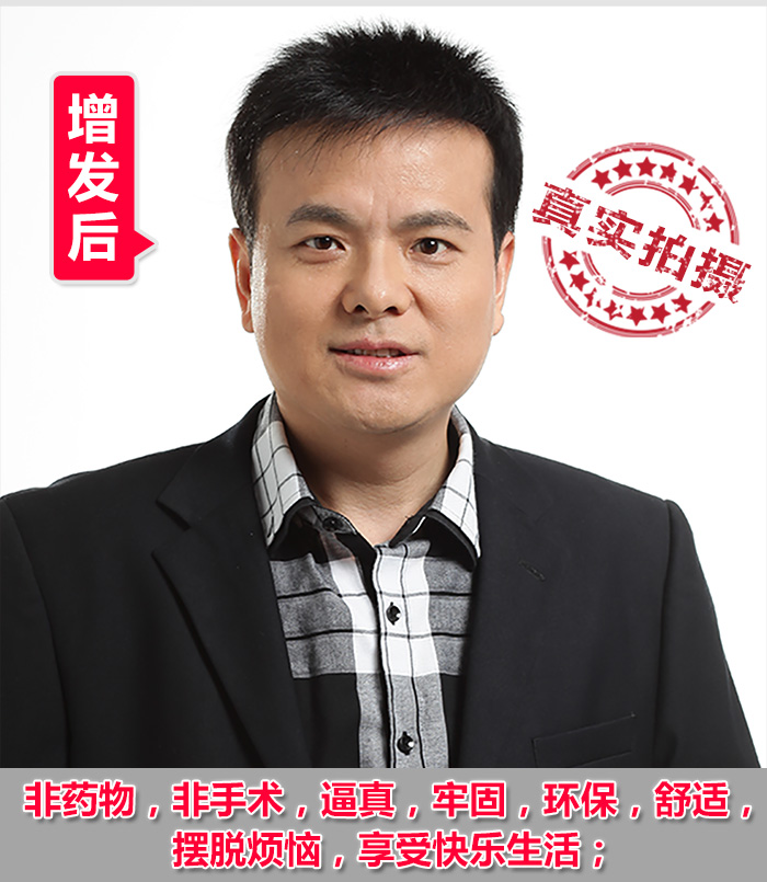 前額頭發(fā)稀疏怎么辦？有什么方法可以解決頭發(fā)稀疏？