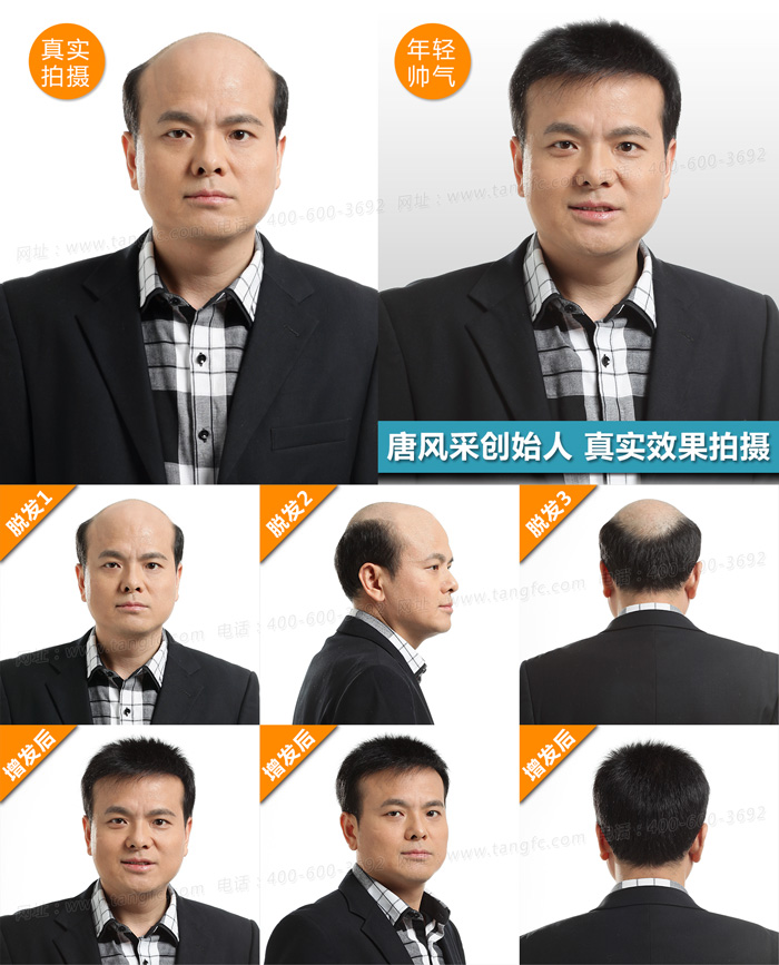 品牌假發(fā)定做 禿頂了,品牌假發(fā)定做為你保駕護(hù)航
