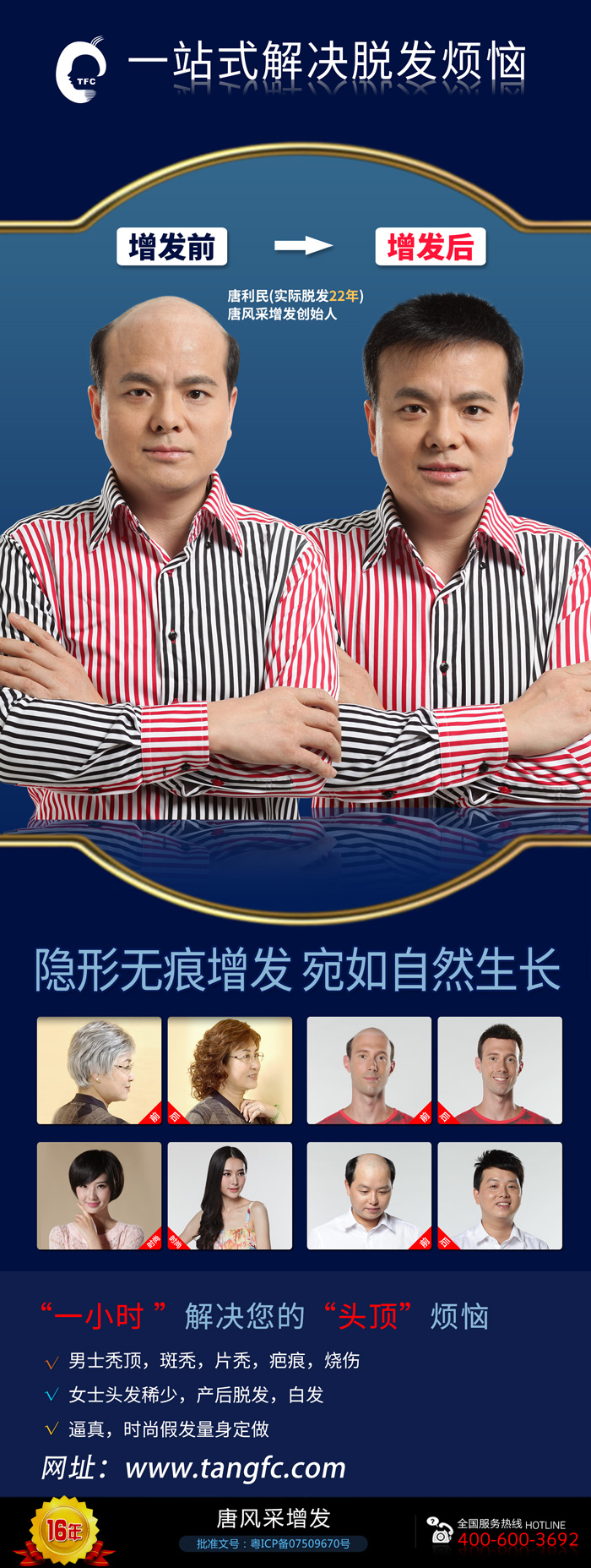 無痕補(bǔ)發(fā)價(jià)格是多少？哪里補(bǔ)發(fā)技術(shù)比較好？