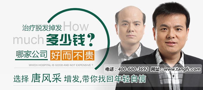 織發(fā)哪個牌子好 織發(fā)哪個牌子好 禿頂可以進行織發(fā)嗎