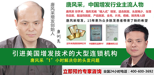 早禿怎么辦？哪里能進(jìn)行男士頭發(fā)加密？