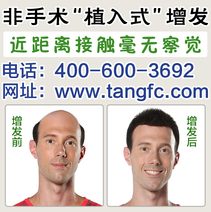 脫發(fā)怎么辦？品牌假發(fā)定做技術(shù)成熟嗎？
