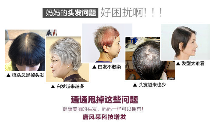 日常習(xí)慣要注意，防火防盜防白發(fā)脫發(fā)！