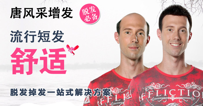 禿發(fā)可以補(bǔ)發(fā)嗎？補(bǔ)發(fā)會(huì)掉嗎？