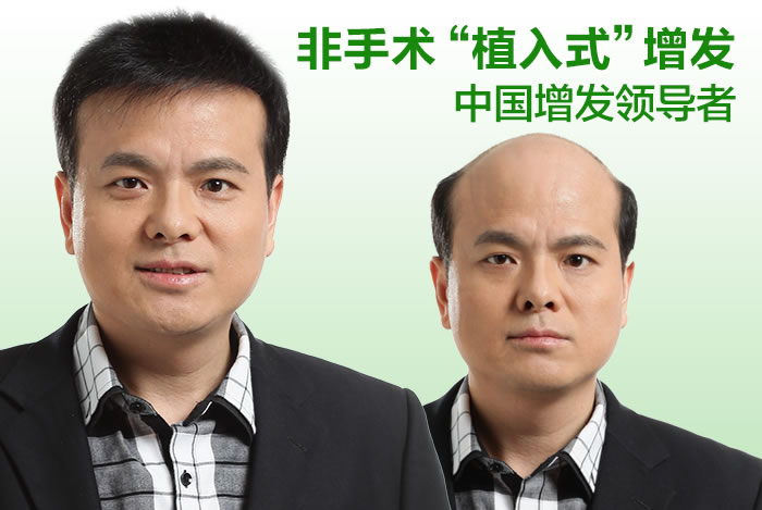 頭發(fā)稀少用什么？預(yù)防與解決需要懂這些