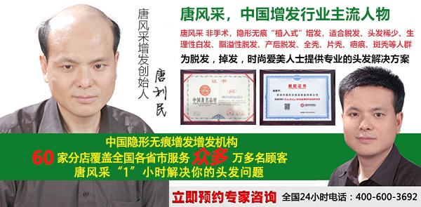 大連自然織發(fā)找哪家好？脫發(fā)復(fù)原就靠這個了！
