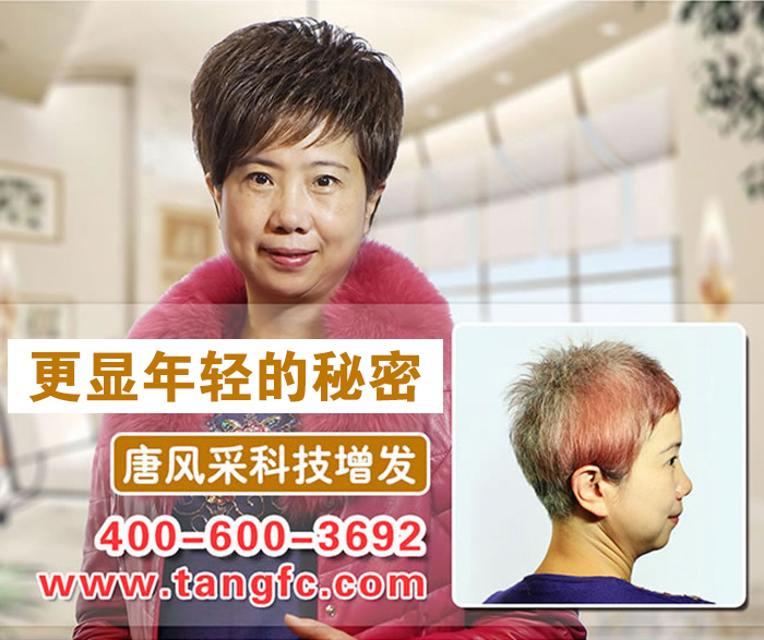 南寧最好的織發(fā)店在哪？脫發(fā)用織發(fā)可以救嗎？