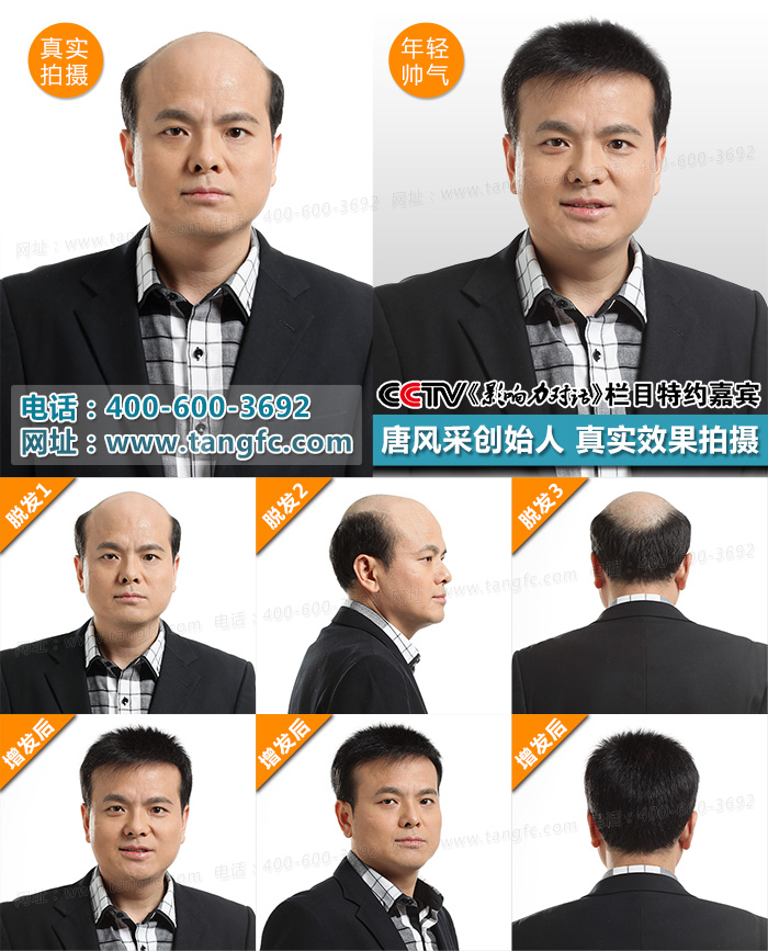根據(jù)男士假發(fā)對比效果，哪個(gè)品牌假發(fā)值得信賴