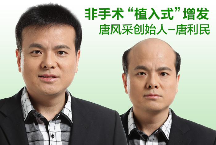 唐風(fēng)采補(bǔ)發(fā)合肥店怎么樣？隱形無痕的效果是真實(shí)的嗎？