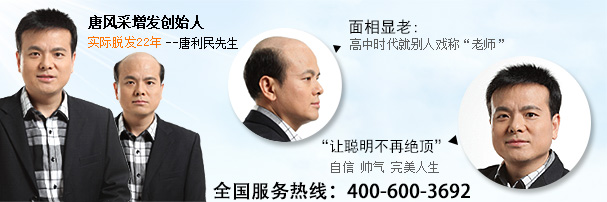 技術(shù)高超的織發(fā)補發(fā)需要多少錢？收費僅每單位119元
