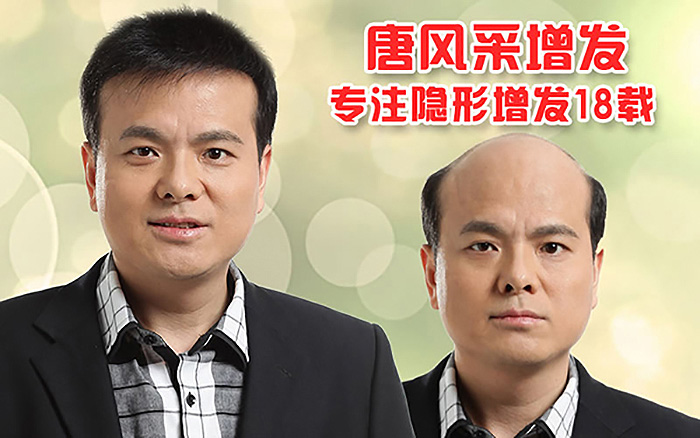 哪種男士發(fā)型好看？掉頭發(fā)怎么辦