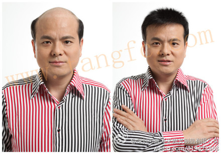 如何選擇男士假發(fā)專賣店？這類人易得雄脫