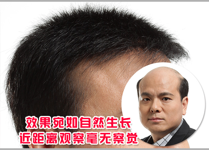 唐風(fēng)采補(bǔ)發(fā)合肥店怎么樣？隱形無痕的效果是真實(shí)的嗎？