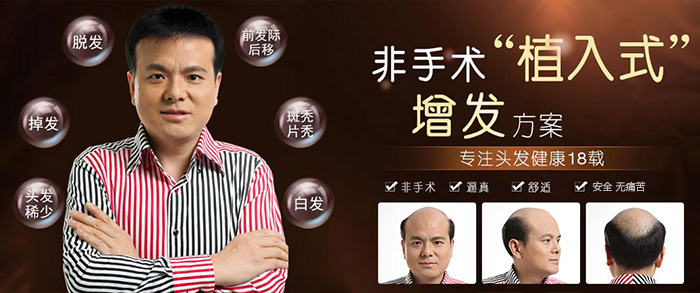 蘇州補(bǔ)發(fā)多少錢？唐風(fēng)采幫你快速解決形象問(wèn)題