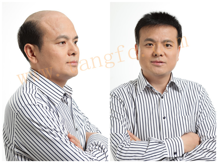 蘭州織發(fā)哪里效果最好？唐風(fēng)采蘭州店給您滿意答案！