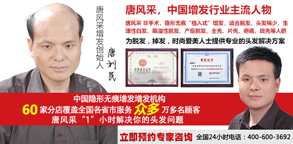 傳統(tǒng)男士假發(fā)套和補發(fā)的區(qū)別，長期戴哪種更好？