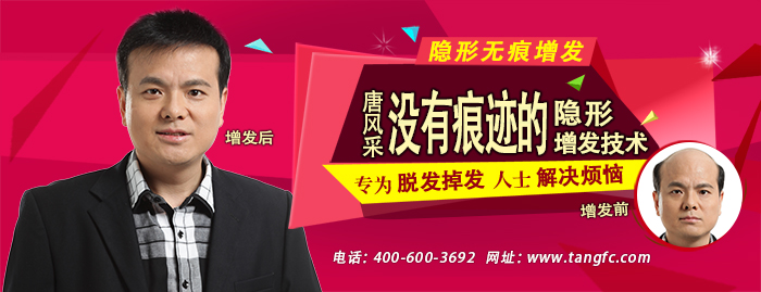 在佛山有哪些織發(fā)補(bǔ)發(fā)店？唐風(fēng)采這家怎么樣？