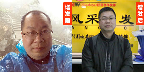常德織發(fā)哪里好？細(xì)節(jié)決定成敗!