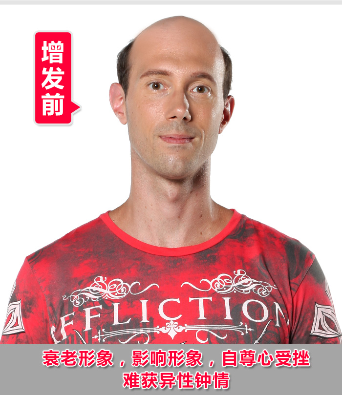 石家莊真人假發(fā)如何選？什么牌子值得推薦？
