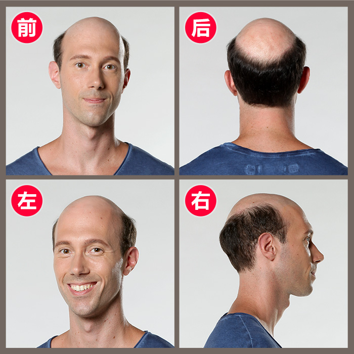金華織發(fā)哪里效果最好？論效果當(dāng)屬唐風(fēng)采增發(fā)！