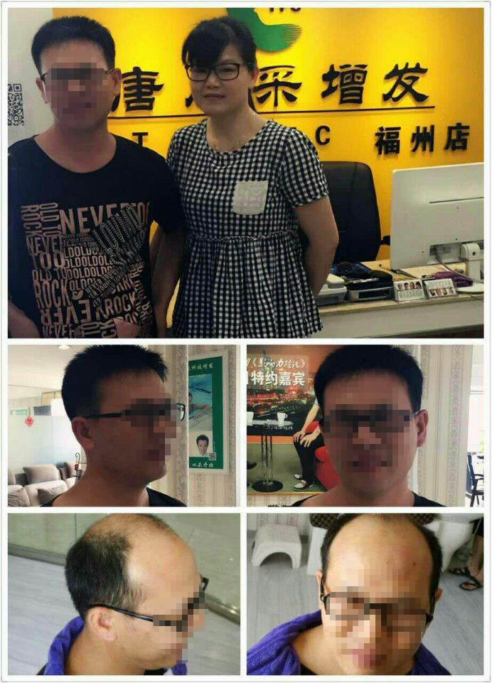 脫發(fā)后“藍瘦、香菇”，那你還在等什么？