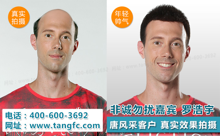 明星很逼真的假發(fā)，渾然天成的感覺是怎么做到的？