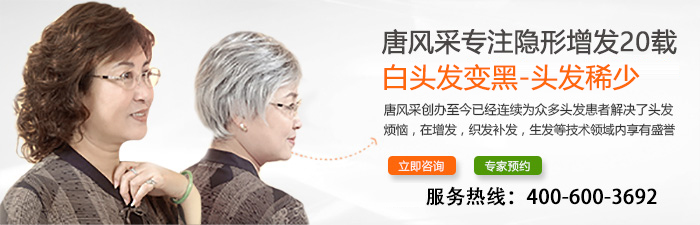 長(zhǎng)沙假發(fā)什么牌子好？千萬(wàn)別貪小便宜吃了大虧