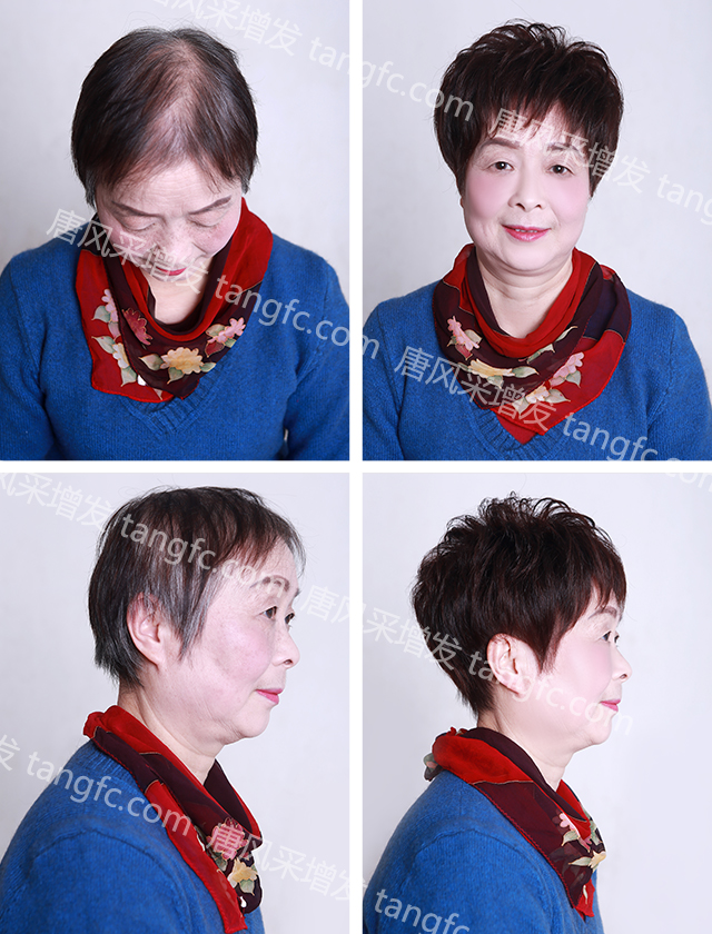 織發(fā)補發(fā)可以使人有好心情，好心情則可以改變命運