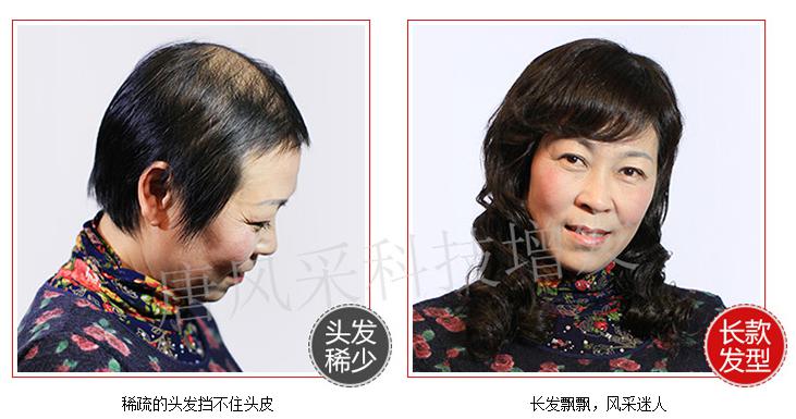 嘉興織發(fā)補發(fā)中心，唐風采專業(yè)補發(fā)塑造完美形象