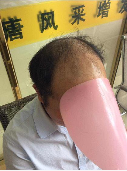 沒有對比就沒有傷害，唐風(fēng)采增發(fā)品質(zhì)看得見！