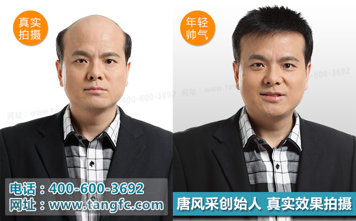 奧尼爾戴白發(fā)開懟，小伙伴們千萬別模仿！