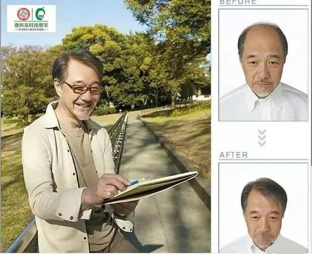 來自NASA的黑科技生發(fā)頭盔，禿頂有救了？