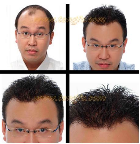 來自NASA的黑科技生發(fā)頭盔，禿頂有救了？