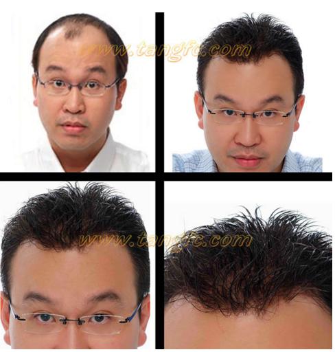 哪家假發(fā)適合脫發(fā)人？金華哪里有假發(fā)專賣店？