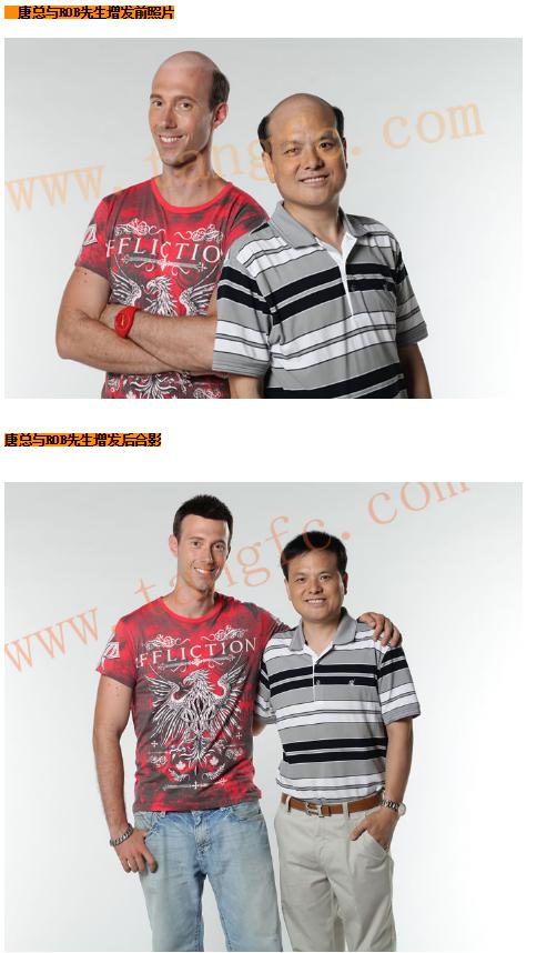 貝克漢姆的中年危機(jī)，脫發(fā)繞過(guò)誰(shuí)？