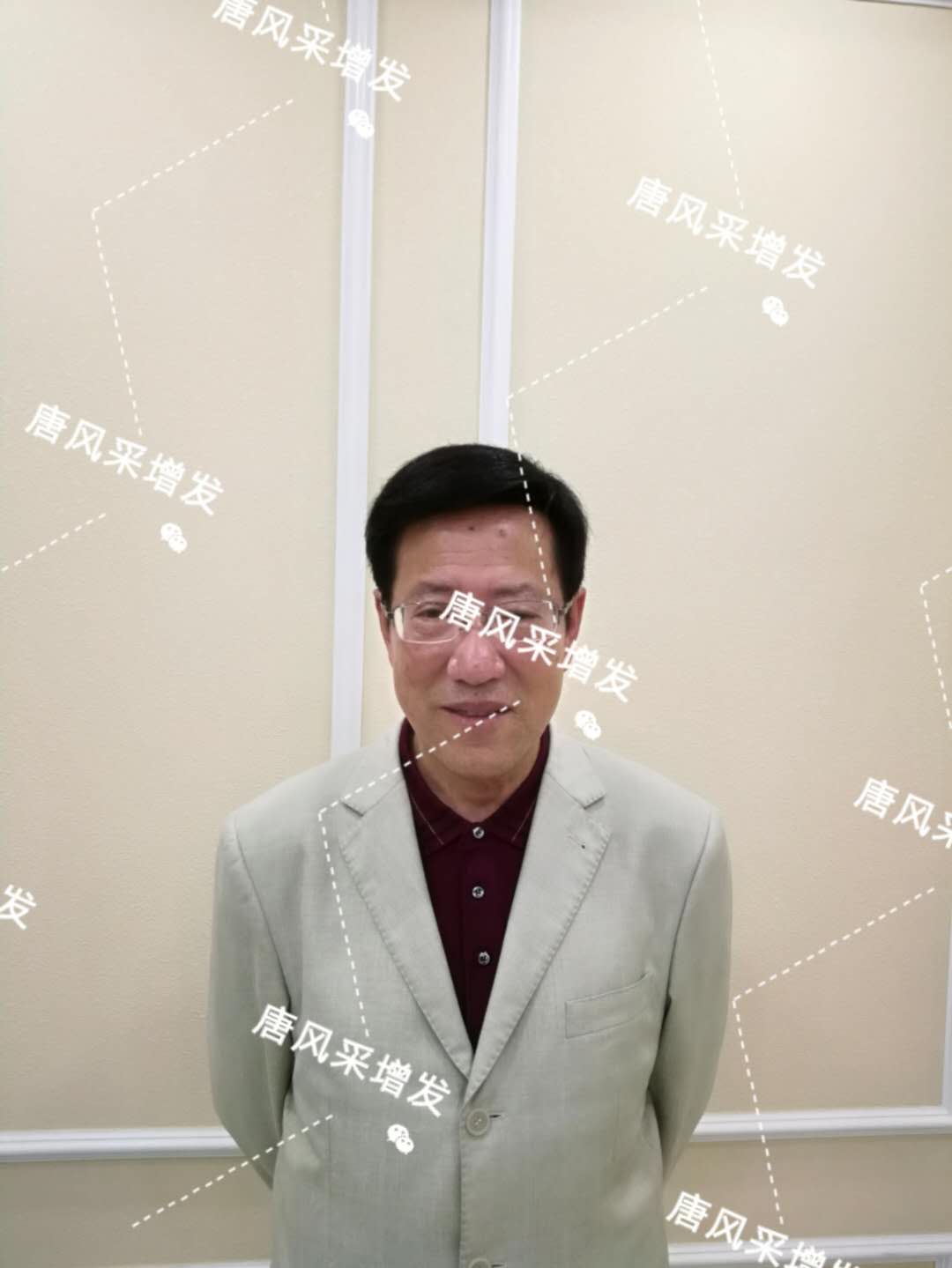 脫發(fā)禿頂成中年男人標(biāo)配？唐風(fēng)采增發(fā)讓您風(fēng)采始終如一