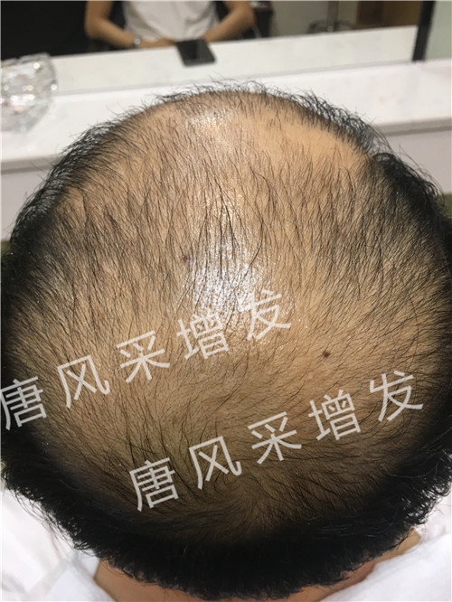 今天咱不看廣告宣傳了，唐風(fēng)采真實(shí)效果，上圖上視頻