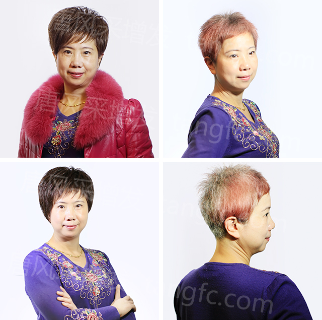 柳州織發(fā)假發(fā)訂做，效果杠杠不負(fù)好時光！