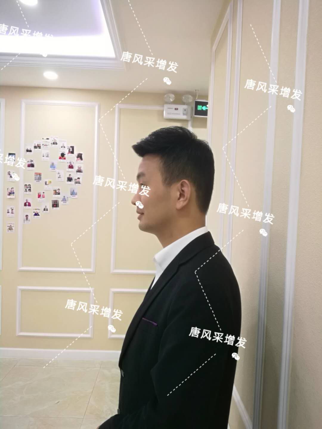 輸了頭發(fā)不能輸氣質(zhì)，看帥哥的逆襲之路！